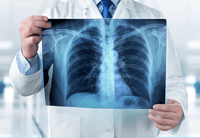 Proper X-Ray Disposal For Healthcare Service Providers | IntelliShred